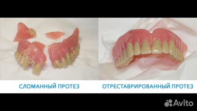 Приклеить пломбу в домашних условиях Приклеить пломбу в домашних условиях