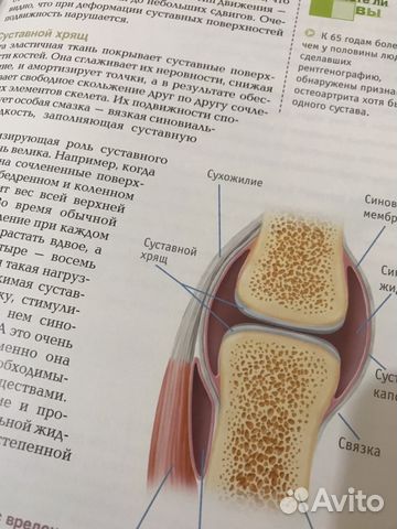 Подарочная книга об умении жить с артритом