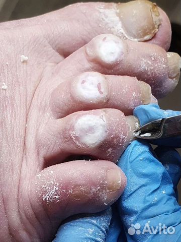 Маникюр и педикюр